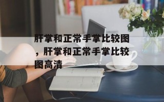 肝掌和正常手掌比较图，肝掌和正常手掌比较图高清