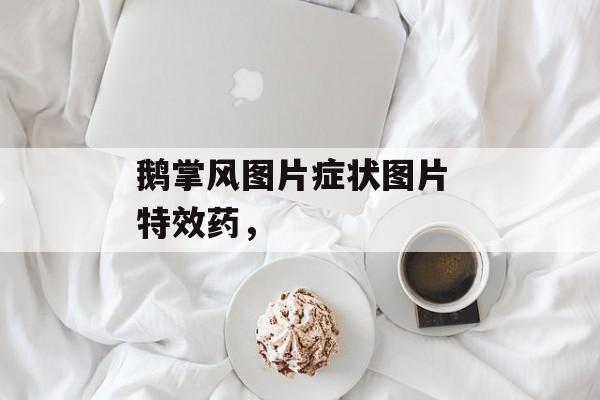 鹅掌风图片症状图片 特效药，-第1张图片-