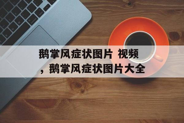 鹅掌风症状图片 视频，鹅掌风症状图片大全-第1张图片-